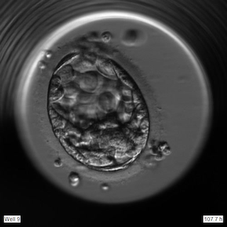 Picture of an embryo